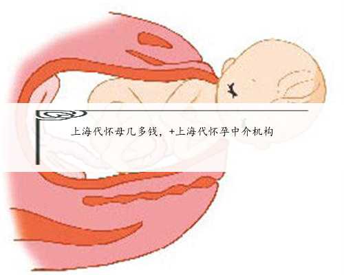 上海代怀母几多钱， 上海代怀孕中介机构